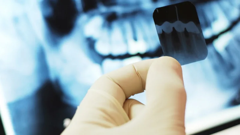 Диагностика зубов — что смотрят врачи?